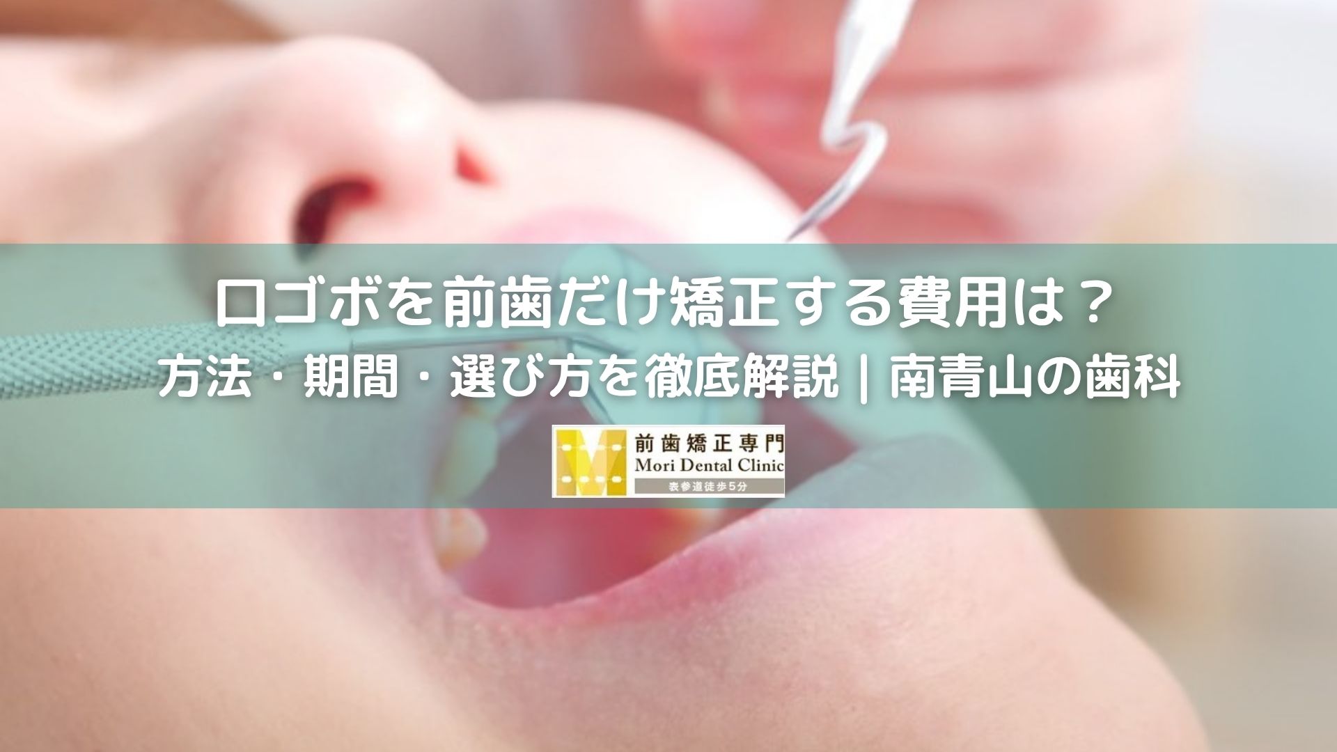 口ゴボを前歯だけ矯正する費用は？方法・期間・選び方を徹底解説｜南青山の歯科