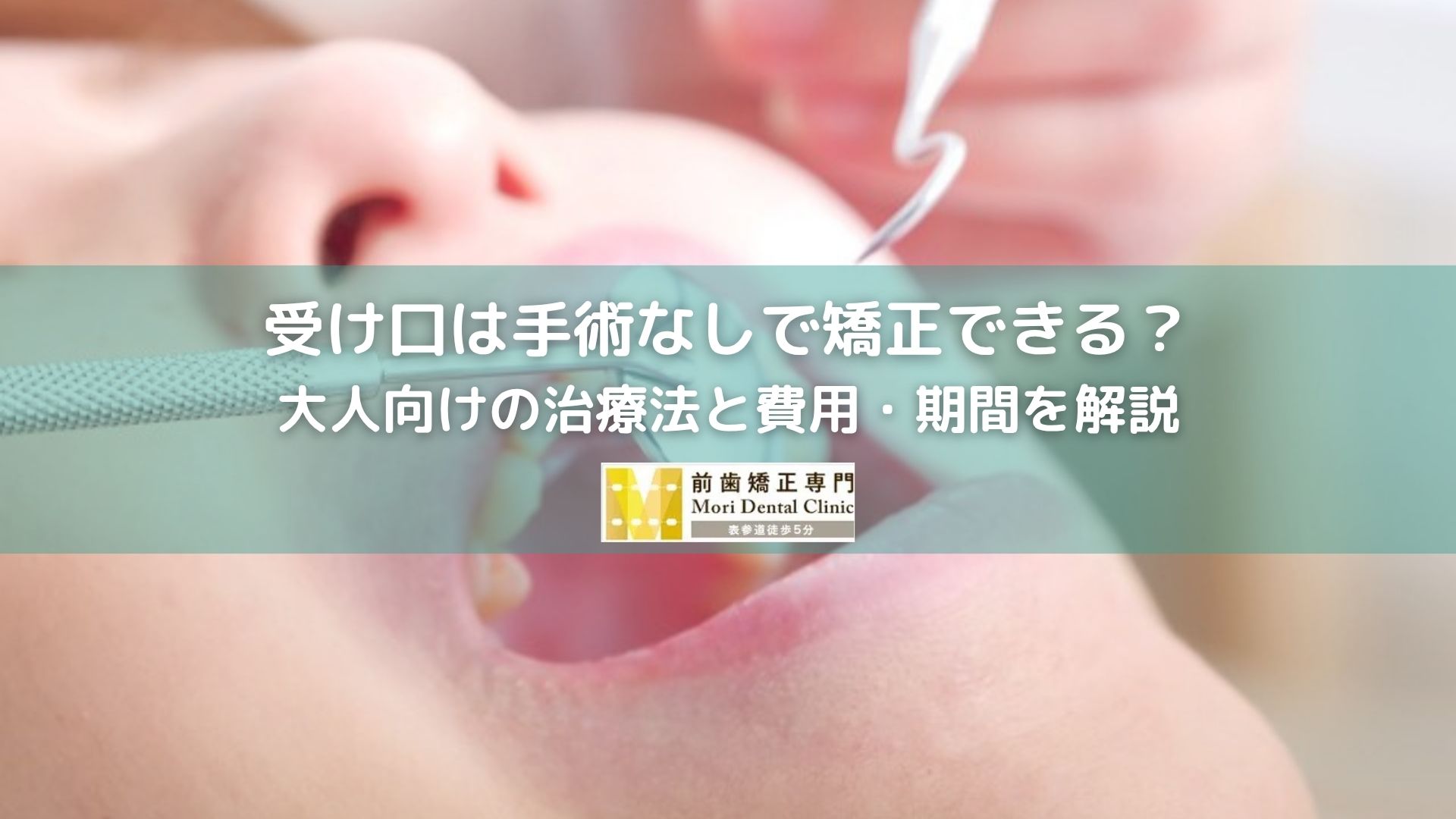 受け口は手術なしで矯正できる？大人向けの治療法と費用・期間を解説｜南青山の歯科医院